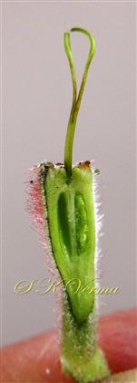  Hypanthium with pistil V.S.